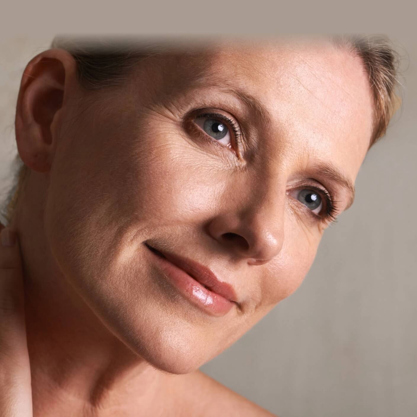Blepharoplasty