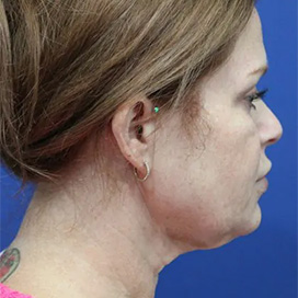 B&A