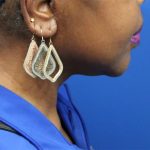 Facelift Before & After Patient #5149