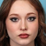 Rhinoplasty Before & After Patient #5286